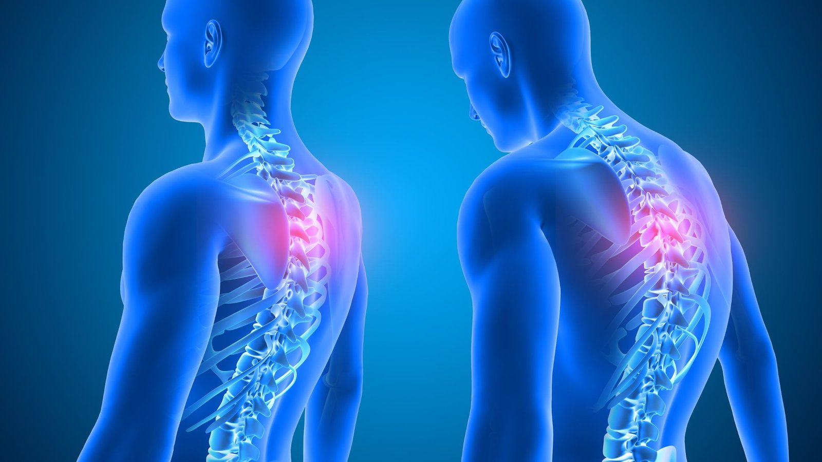 Representación visual de dolor en la columna vertebral y cervical en cuerpos humanos